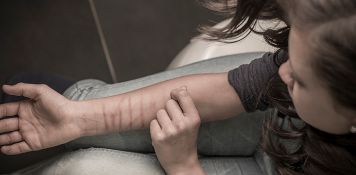 self harm young lady making cuts in her arm
